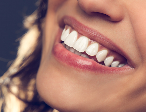 Cosmetic Dentistry